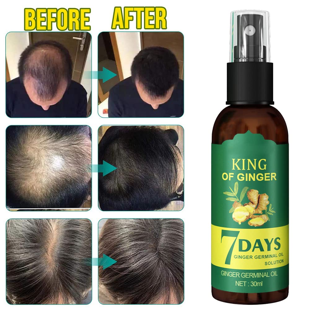 7 Days - Crecimiento Capilar Spray
