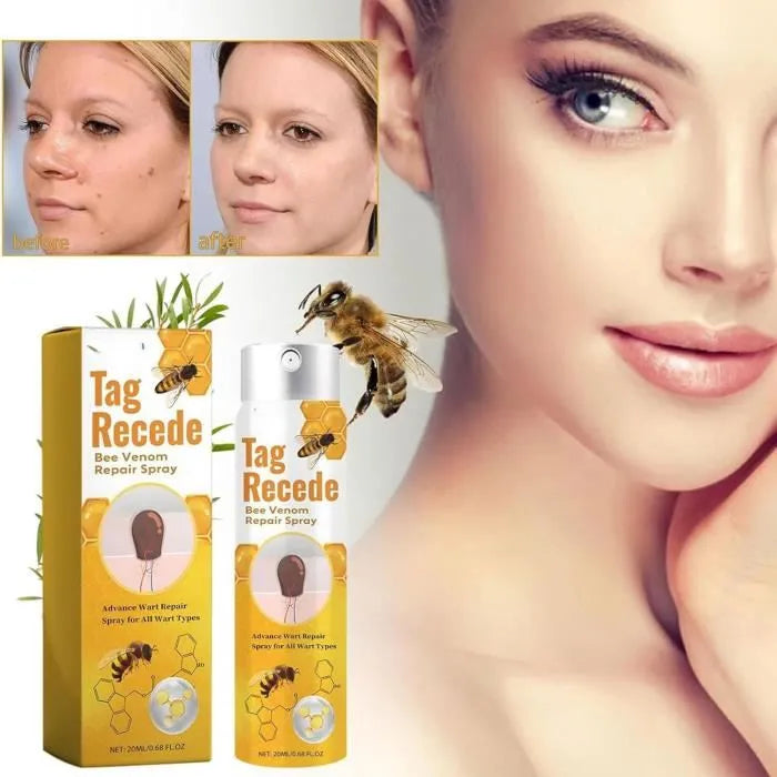 Tag Recede - Eliminador De Verrugas