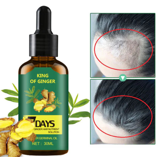 7 Days - Crecimiento Capilar Spray